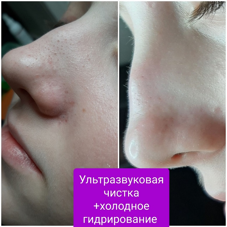 Результат