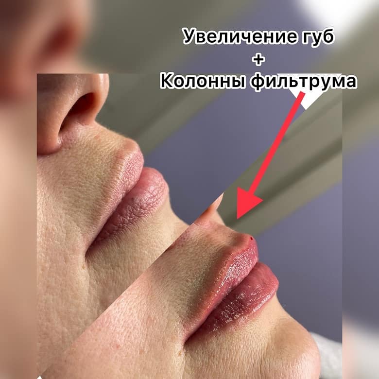 Результат